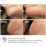 TOUCHBeauty 9-in-1 Electric Foot Callus Remover Kit – Professional Pedicure & Manicure Tool with 9 Attachments, Dual Speed, Battery Operated, Storage Case