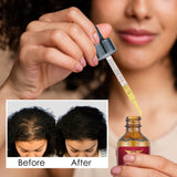 Person holding a dropper with a bottle of oil, showing before and after hair treatment results.