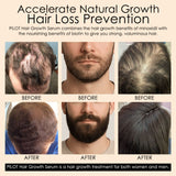 Before and after images of hair growth with text about hair loss prevention and a hair growth serum.