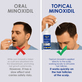 Pilot Minoxidil 5% Hair Regrowth Serum for Men & Women 3×60ml (3 Month Supply) – Extra Strength Topical Treatment for Thinning Hair (Vertex) – With Biotin, Ginseng & Herbal Extracts